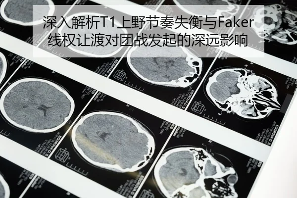 深入解析T1上野节奏失衡与Faker线权让渡对团战发起的深远影响